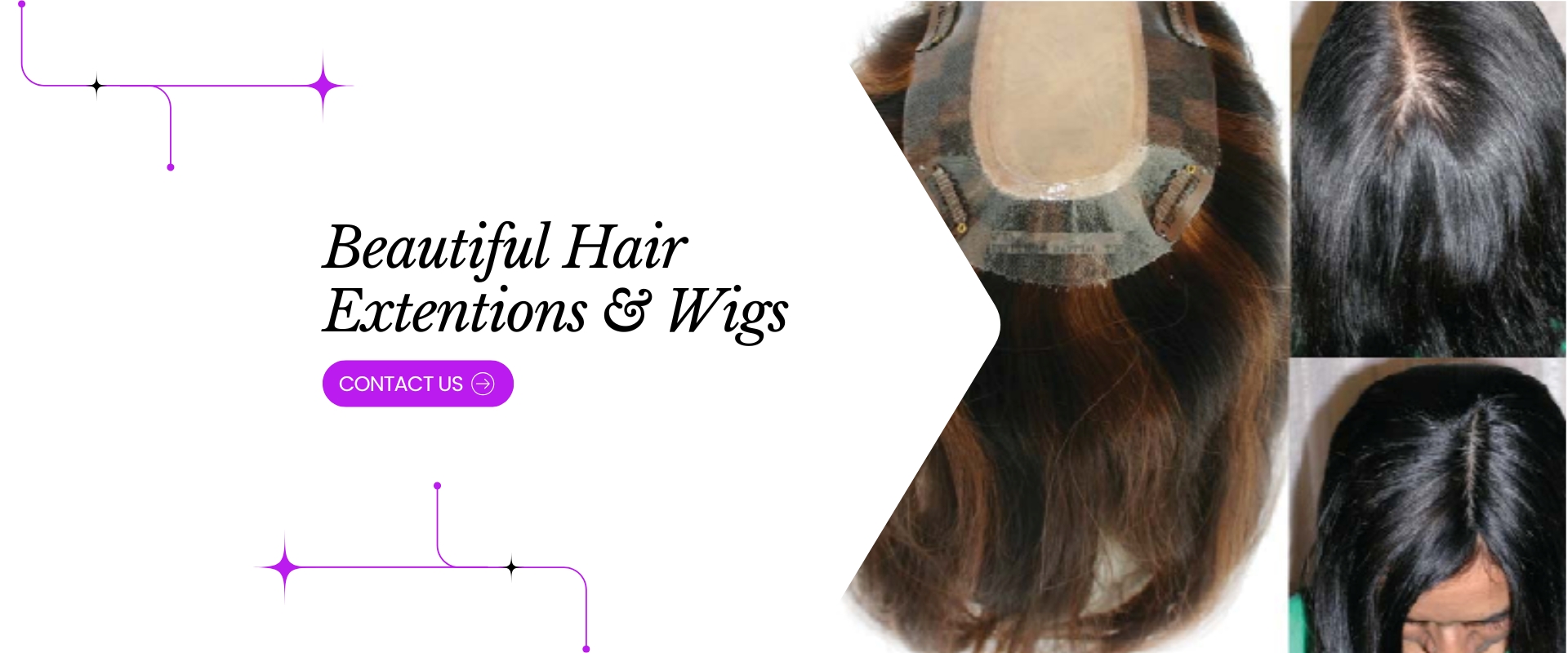 Hair restoration example